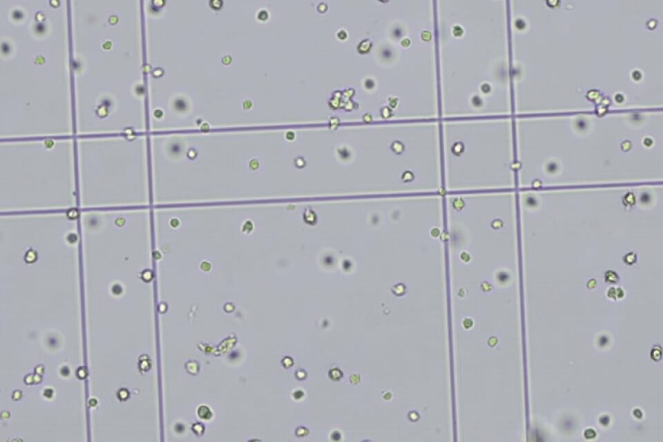 独自設計の配合飼料で育てたバナメイエビの免疫細胞