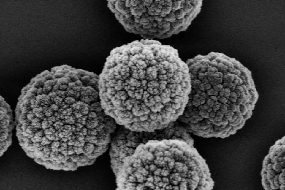 学生が作製した炭素でできた球状粒子の走査型電子顕微鏡写真。ふわふわとした綿毛のような形状をしており、直径は髪の毛の太さの50分の1から100分の1程度